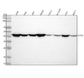 Anti-alpha smooth muscle Actin ACTA2 Rabbit Monoclonal Antibody
