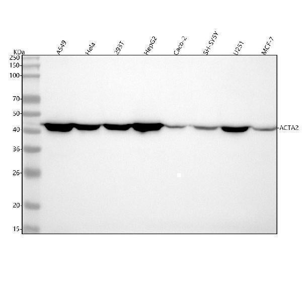 Anti-alpha smooth muscle Actin ACTA2 Rabbit Monoclonal Antibody