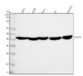 Anti-alpha smooth muscle Actin ACTA2 Rabbit Monoclonal Antibody