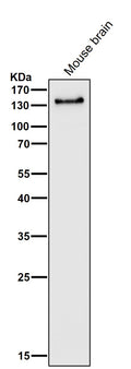 All lanes use the Antibody at 1:3K dilution for 1 hour at room temperature.