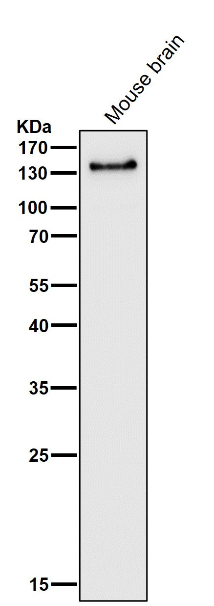 All lanes use the Antibody at 1:3K dilution for 1 hour at room temperature.