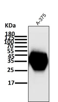 All lanes use the Antibody at 1:1K dilution for 1 hour at room temperature.