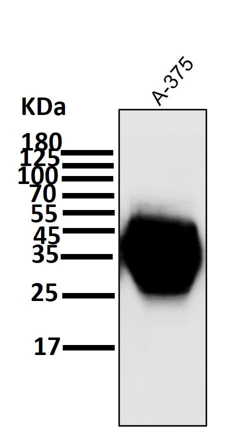 All lanes use the Antibody at 1:1K dilution for 1 hour at room temperature.