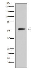 Western blot analysis of CA9 expression in Human stomach lysate.