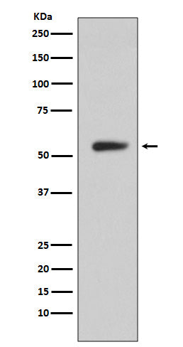Western blot analysis of CA9 expression in Human stomach lysate.