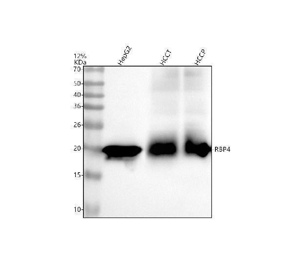 Anti-RBP4 Monoclonal Antibody