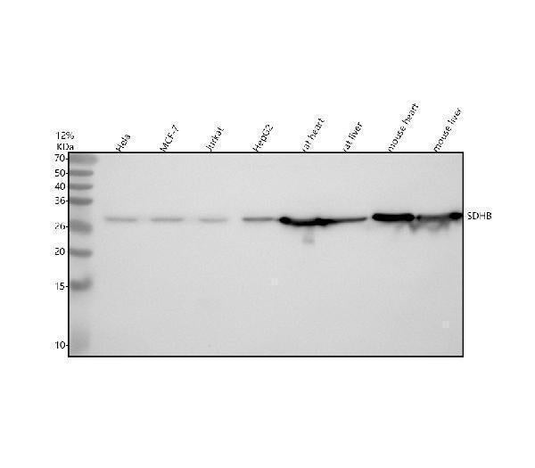 Anti-SDHB Rabbit Monoclonal Antibody