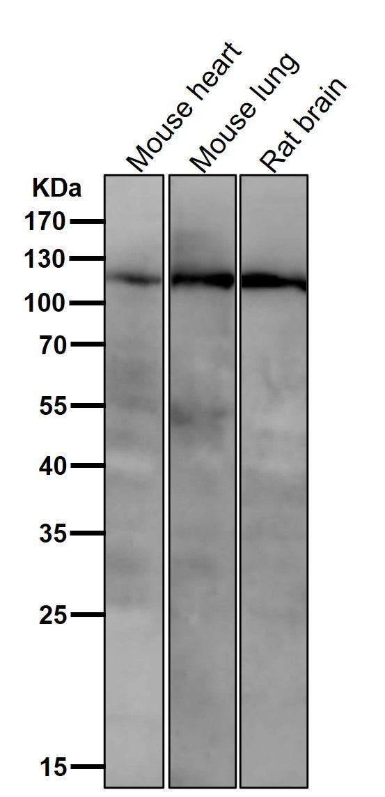 Anti-PI3 Kinase p110 beta Rabbit Monoclonal Antibody