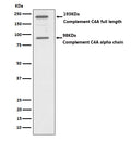 Western blot analysis of C4A expression in HepG2 cell lysate.