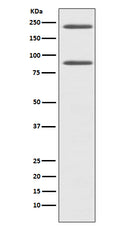 Western blot analysis of C4 expression in HepG2 cell lysate.