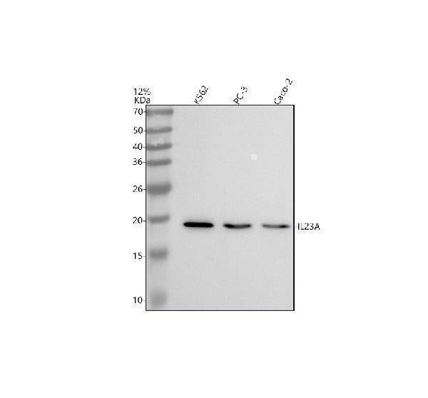 Anti-IL23 Rabbit Monoclonal Antibody