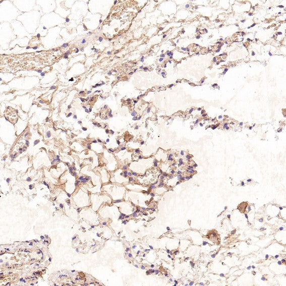 Anti-CD41 ITGA2B Rabbit Monoclonal Antibody