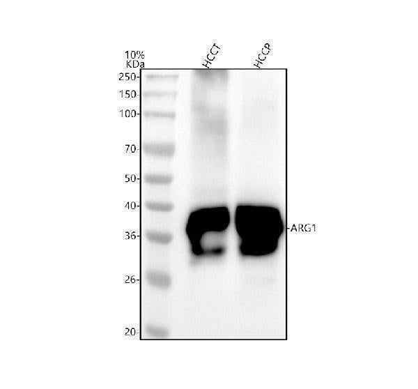 Anti-Liver Arginase ARG1 Rabbit Monoclonal Antibody