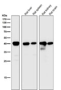 All lanes use the Antibody at 1:1K dilution for 1 hour at room temperature.