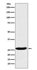 Western blot analysis of CLPP expression in A431 cell lysate.