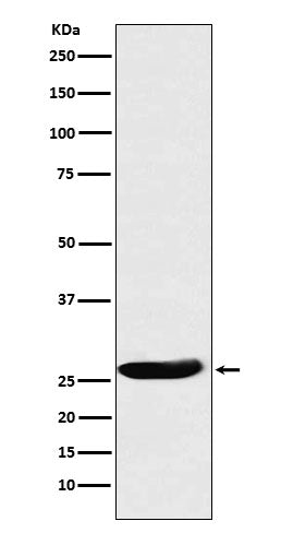 Western blot analysis of CLPP expression in A431 cell lysate.