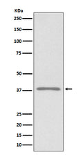Western blot analysis of Podoplanin expression in 293T cell lysate.