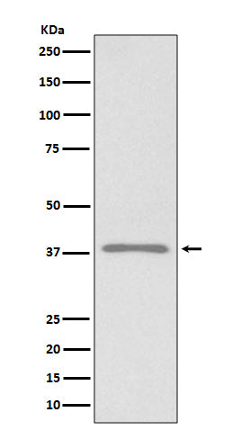 Western blot analysis of Podoplanin expression in 293T cell lysate.