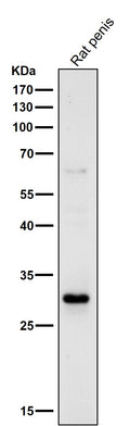 All lanes use the Antibody at 1:1K dilution for 1 hour at room temperature.