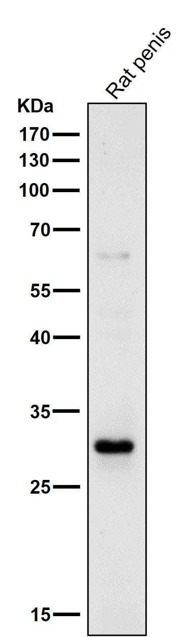 All lanes use the Antibody at 1:1K dilution for 1 hour at room temperature.