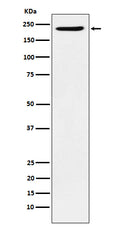 Anti-PBRM1 Rabbit Monoclonal Antibody