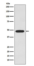 Western blot analysis of Galactosidase alpha expression in MCF-7 cell lysate.