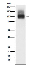 Western blot analysis of Band 3 / CD233 expression in Red blood cell lysate.