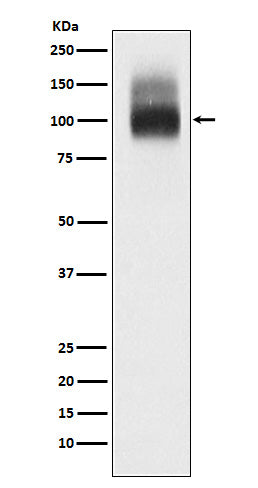 Western blot analysis of Band 3 / CD233 expression in Red blood cell lysate.