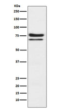 Western blot analysis of PKC epsilon expression in Jurkat cell lysate.
