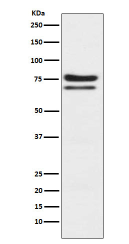 Western blot analysis of PKC epsilon expression in Jurkat cell lysate.