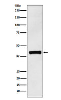 Western blot analysis of IL12 p40 expression in Human IL12 p40 recombinant protein.