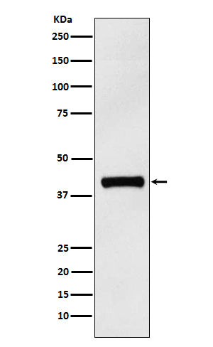 Western blot analysis of IL12 p40 expression in Human IL12 p40 recombinant protein.