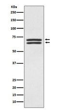 Anti-PDPK1/Pdk 1 Rabbit Monoclonal Antibody