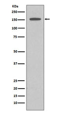 Western blot analysis of DAP Kinase 1 expression in HeLa cell lysate.