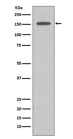 Western blot analysis of DAP Kinase 1 expression in HeLa cell lysate.