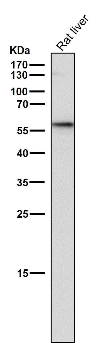 All lanes use the Antibody at 1:5K dilution for 1 hour at room temperature.