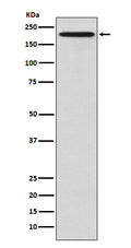 Western blot analysis of GCN2 expression in HeLa cell lysate.