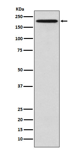Western blot analysis of GCN2 expression in HeLa cell lysate.