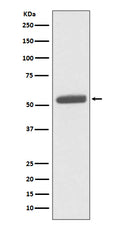 Western blot analysis of PKM2 expression in HeLa cell lysate.