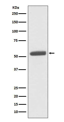 Western blot analysis of PKM2 expression in HeLa cell lysate.