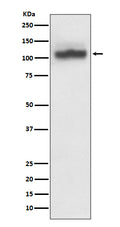 Western blot analysis of SERCA2 expression in HeLa cell lysate.