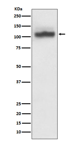 Western blot analysis of SERCA2 expression in HeLa cell lysate.