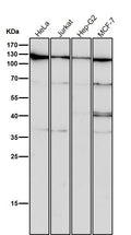 All lanes use the Antibody at 1:1W dilution for 1 hour at room temperature.