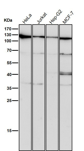 All lanes use the Antibody at 1:1W dilution for 1 hour at room temperature.