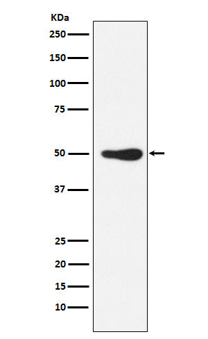Western blot analysis of FOXL2 expression in Jurkat cell lysate.