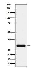 Western blot analysis of BNP expression in human plasma lysate.