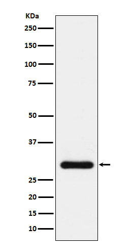 Western blot analysis of BNP expression in human plasma lysate.