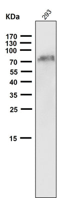 All lanes use the Antibody at 1:1W dilution for 1 hour at room temperature.