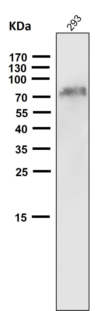 All lanes use the Antibody at 1:1W dilution for 1 hour at room temperature.