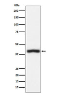 Western blot analysis of CD1c expression in Jurkat cell lysate.